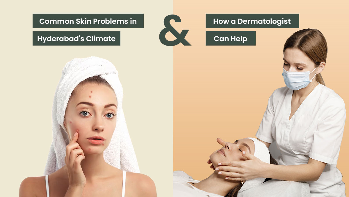 Common Skin Problems