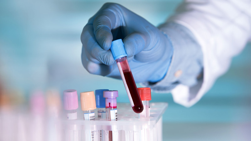 How Private Blood Tests Can Provide a Deeper Understanding of Your Health