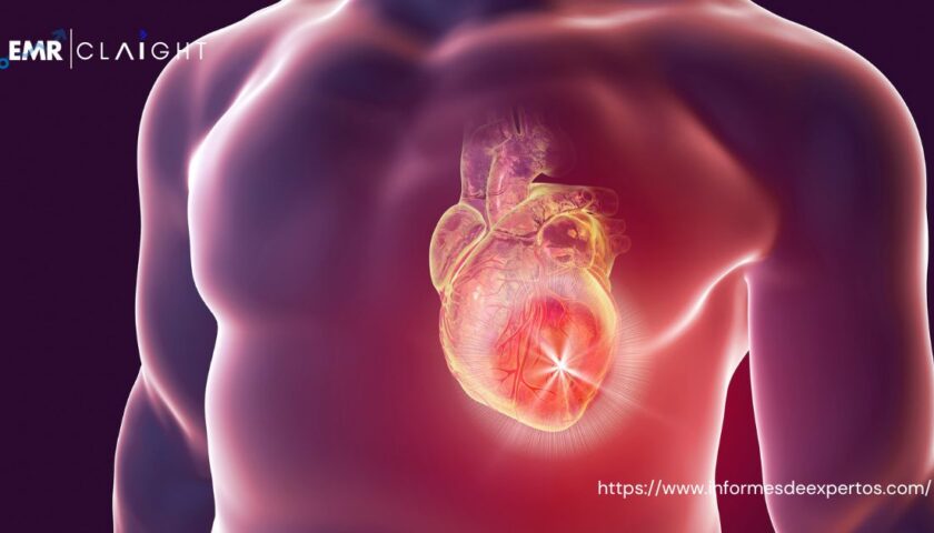Mercado de Biomarcadores Cardíacos