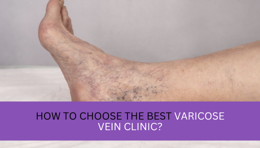 Varicose Vein Clinic