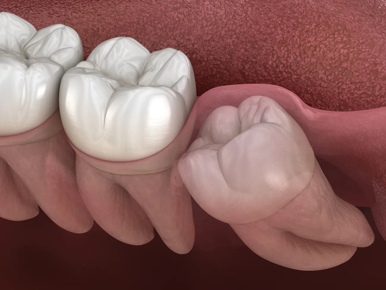 Oral and maxillofacial surgery offers several options for those suffering from sleep apnea. Each procedure targets the underlying causes of this condition, aiming to improve airflow during sleep.