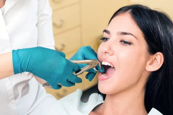 Dentistry for Tooth Extractions