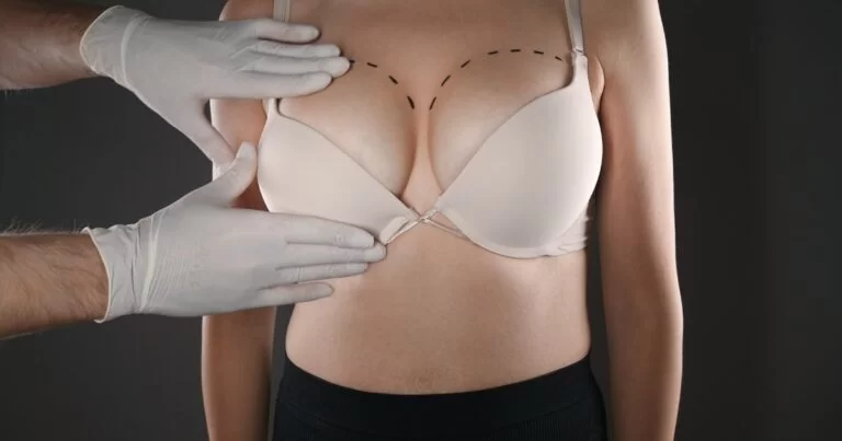 How to Prepare for Surgery with the Best Breast Augmentation Surgeon in Dubai