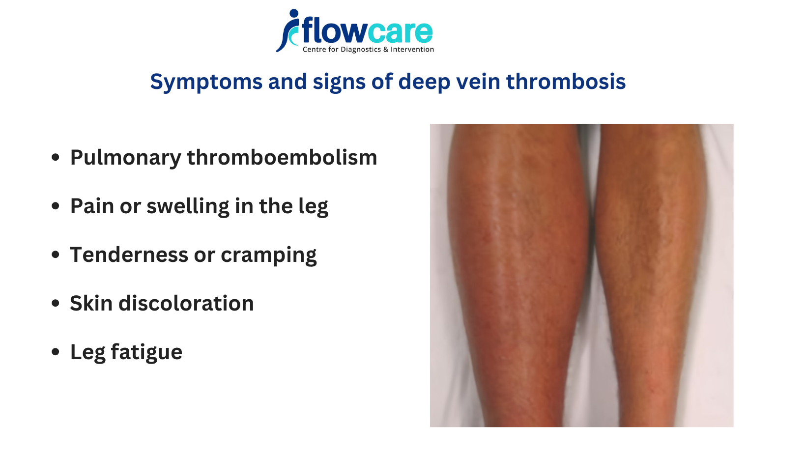 DVT-symptoms