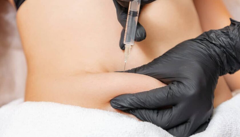 Lipotropic Injections