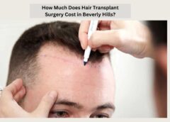 hair transplant surgery cost