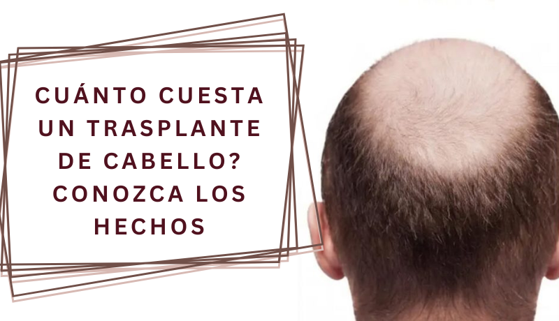 cuanto cuesta un trasplante de cabello