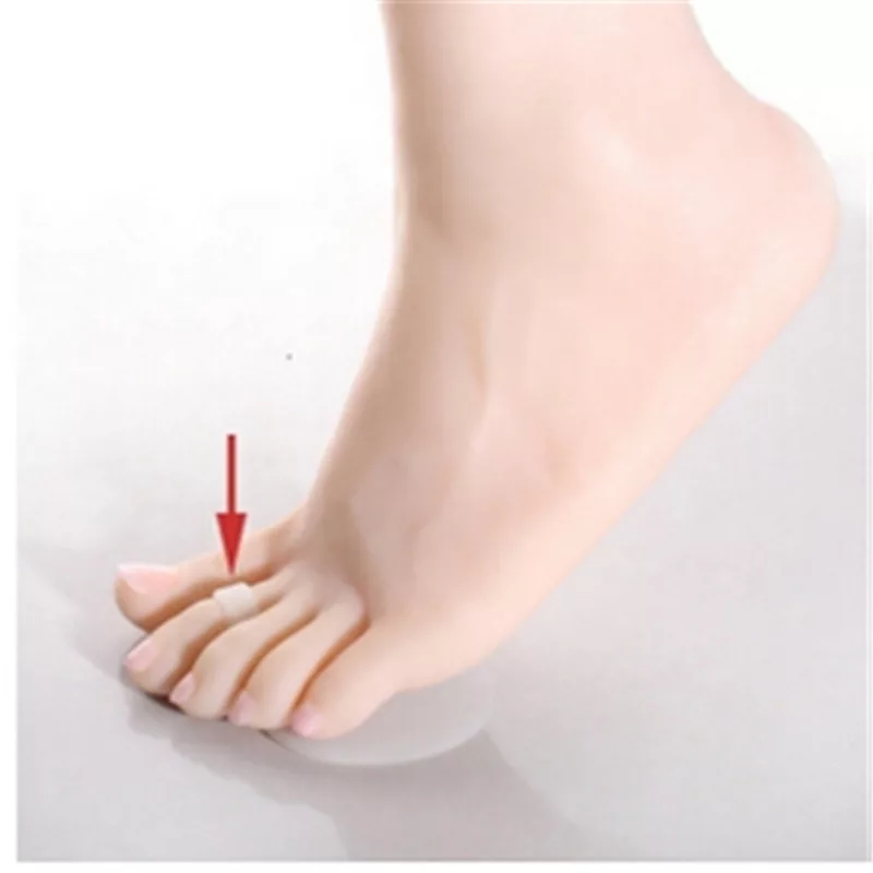 Foot Pain & Treatment Solutions – Best Footcare in Edinburgh