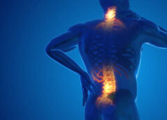 Back Pain Management