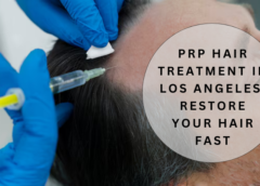 prp hair treatment Los Angeles